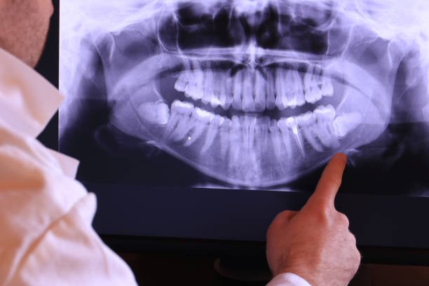 Best Orthodontic Emergency Dentist in Yoakum, TX