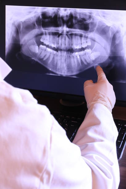 Best Emergency Dentist for Knocked-Out Tooth in Yoakum, TX