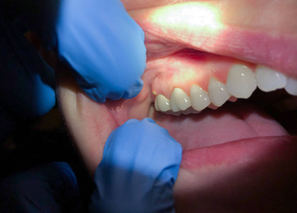 Best Orthodontic Emergency Dentist in Yoakum, TX