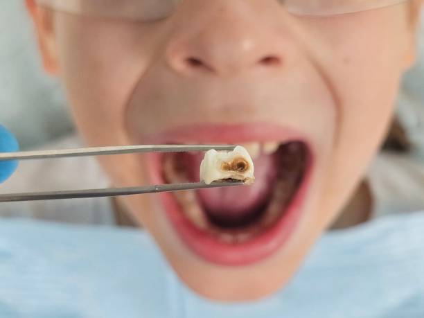 Best Emergency Dental Services for Seniors in Yoakum, TX